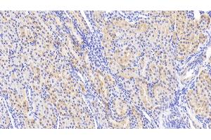Detection of Slit2 in Human Kidney Tissue using Polyclonal Antibody to Slit Homolog 2 (Slit2) (SLIT2 antibody  (AA 664-777))