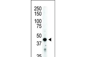 The STK12 polyclonal antibody (ABIN391354 and ABIN2841375) is used in Western blot to detect STK12 in mouse spleen tissue lysate. (Aurora-B (ARK/STK12) (AA 283-313) antibody)