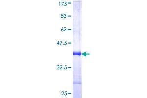 LAMP2 Protein (AA 30-127) (GST tag)
