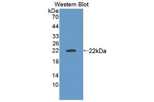 Western blot analysis of the recombinant protein. (MEF2A antibody  (AA 1-162))