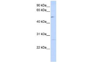 PPM1M antibody used at 1 ug/ml to detect target protein. (PPM1M antibody)