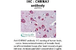 Image no. 1 for anti-Cholinergic Receptor, Nicotinic, alpha 7 (Neuronal) (CHRNA7) (Internal Region) antibody (ABIN1733072) (CHRNA7 antibody  (Internal Region))