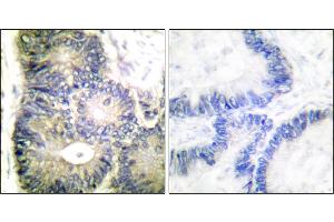 Immunohistochemical analysis of paraffin-embedded human colon carcinoma tissue using Cytochrome c antibody.