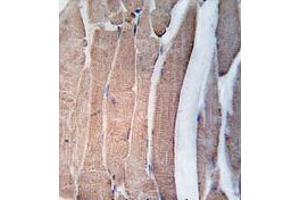 Formalin-fixed and paraffin-embedded human skeletal muscle tissue reacted with DAPK2 Antibody (N-term) , which was peroxidase-conjugated to the secondary antibody, followed by DAB staining. (DAPK2 antibody  (N-Term))