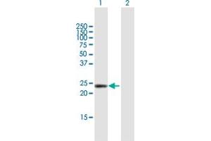 Western Blot analysis of DMRTB1 expression in transfected 293T cell line by DMRTB1 MaxPab polyclonal antibody. (DMRTB1 antibody  (AA 1-189))