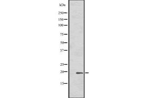 Western blot analysis of HSPB7 expression in Human fetal heart cell lysate ,The lane on the left is treated with the antigen-specific peptide. (HSPB7 antibody  (C-Term))