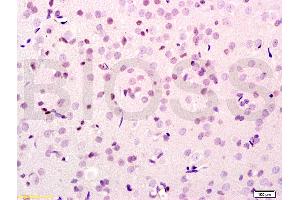 Formalin-fixed and paraffin embedded rat brain tissue labeled with Anti-SMURF2 Polyclonal Antibody, Unconjugated (ABIN753178) at 1:200 followed by conjugation to the secondary antibody, (SP-0023), and DAB staining (SMURF2 antibody  (AA 601-700))
