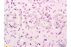 Formalin-fixed and paraffin embedded rat brain tissue labeled with Anti-SMURF2 Polyclonal Antibody, Unconjugated (ABIN753178) at 1:200 followed by conjugation to the secondary antibody, (SP-0023), and DAB staining (SMURF2 antibody  (AA 601-700))