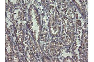 Image no. 4 for anti-RAB30, Member RAS Oncogene Family (RAB30) antibody (ABIN1500557)