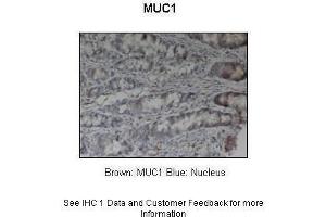 Sample Type :  Pig stomach  Primary Antibody Dilution :  1:200  Secondary Antibody :  Anti-rabbit-HRP  Secondary Antibody Dilution :  1:1000  Color/Signal Descriptions :  Brown: MUC1 Blue: Nucleus  Gene Name :  MUC1  Submitted by :  Dr.