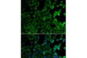 Immunofluorescence analysis of HeLa cells using MSR1 Polyclonal Antibody (Macrophage Scavenger Receptor 1 antibody)