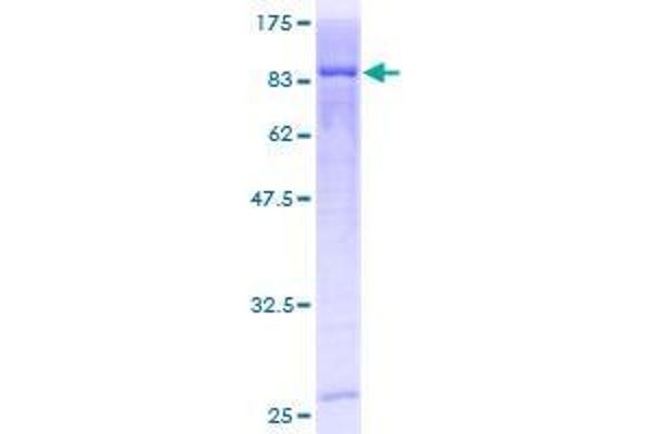 CDKN2AIP Protein (AA 1-579) (GST tag)