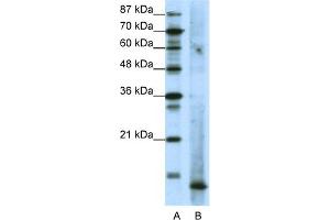 WB Suggested Anti-MDS1 Antibody Titration:  1. (MECOM antibody  (N-Term))