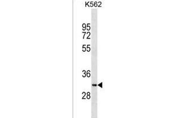 SYCE1L antibody  (C-Term)