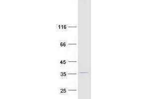 Zinc Finger Protein 747 (ZNF747) protein (Myc-DYKDDDDK Tag)