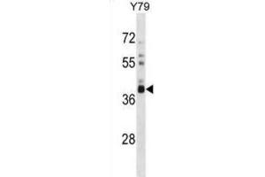 Western Blotting (WB) image for anti-Olfactory Receptor, Family 52, Subfamily L, Member 1 (OR52L1) antibody (ABIN5018293) (OR52L1 antibody)