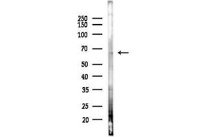 anti-Solute Carrier Family 22 (Organic Anion Transporter), Member 8 (SLC22A8) (N-Term) antibody