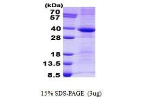 Image no. 1 for Cathepsin S (CTSS) protein (His tag) (ABIN1098767)