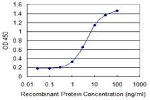 Detection limit for recombinant GST tagged PLEC1 is 0. (PLEC antibody  (AA 4384-4493))