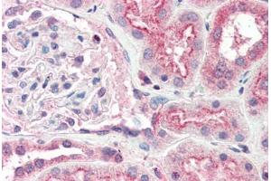 Human Kidney (formalin-fixed, paraffin-embedded) stained with OGG1 antibody ABIN337126 at 2. (OGG1 antibody  (AA 282-297))