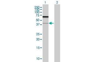 Lane 1: HEXIM1 transfected lysate ( 39. (HEXIM1 293T Cell Transient Overexpression Lysate(Denatured))