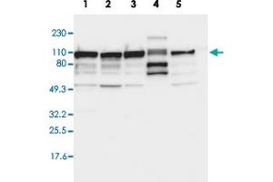 Western blot analysis of Lane 1: RT-4, Lane 2: U-251 MG, Lane 3: A-431, Lane 4: Liver, Lane 5: Tonsil with CTAGE5 polyclonal antibody . (MIA2 antibody  (AA 392-507))