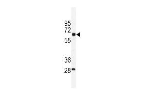 Western blot analysis of PKM1 antibody (C-term ) (ABIN391688 and ABIN2841593) in mouse testis tissue lysates (35 μg/lane). (PKM1 (AA 383-417), (C-Term) antibody)