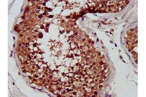 IHC image of ABIN7148543 diluted at 1:400 and staining in paraffin-embedded human testis tissue performed on a Leica BondTM system. (CUTC antibody  (AA 1-64))