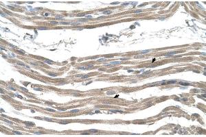 Human Muscle (SLC25A22 antibody  (N-Term))