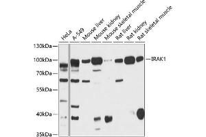 Western blot analysis of extracts of various cell lines, using IR antibody (ABIN6130497, ABIN6142514, ABIN6142515 and ABIN6216327) at 1:3000 dilution. (IRAK1 antibody  (AA 424-633))