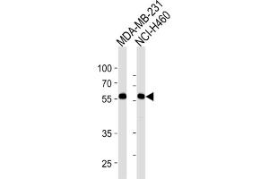 Western Blotting (WB) image for anti-Raftlin, Lipid Raft Linker 1 (RFTN1) antibody (ABIN3004469)
