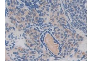 Immunohistochemistry (IHC) image for anti-Chordin (CHRD) (AA 422-635) antibody (ABIN7441952)