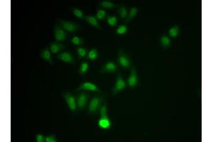 Immunofluorescence analysis of MCF-7 cell using CHAT antibody. (Choline Acetyltransferase antibody  (AA 331-630))