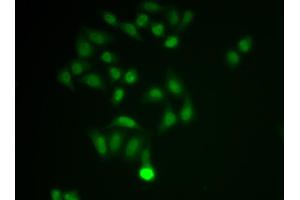 Immunofluorescence analysis of MCF-7 cell using CHAT antibody. (Choline Acetyltransferase antibody  (AA 331-630))