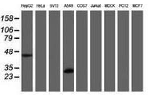 Image no. 2 for anti-Mitochondrial Translational Initiation Factor 3 (MTIF3) (AA 56-278) antibody (ABIN1491593)