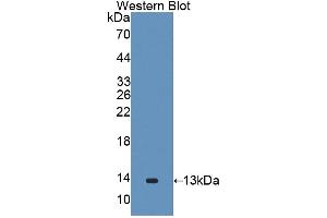 Western blot analysis of the recombinant protein. (GALP antibody  (AA 29-115))