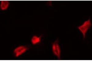 ABIN6267537 staining Hela by IF/ICC. (YAP1 antibody  (pSer127))