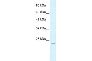WB Suggested Antibody Titration:  0. (FOXP2 antibody  (N-Term))