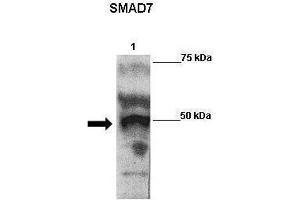 WB Suggested Anti-SMAD7 Antibody    Positive Control:  Lane 1: 2ug Flag-SMAD7 transfected 293 extracts   Primary Antibody Dilution :   1:500  Secondary Antibody :  Goat anti-rabbit-HRP   Secondry Antibody Dilution :   1:5000  Submitted by:  Anonymous (SMAD7 antibody  (N-Term))