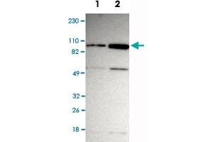 Western Blot analysis of Lane 1: RT-4 and Lane 2: U-251MG sp cell lysates with ZNF267 polyclonal antibody .
