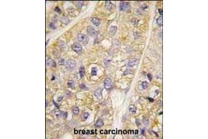 Immunohistochemistry (Paraffin-embedded Sections) (IHC (p)) image for anti-Phosphatidylinositol 4-Kinase Type 2 beta (PI4K2B) (AA 1-30), (N-Term) antibody (ABIN392588)