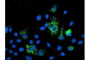 Anti-NIF3L1 mouse monoclonal antibody (ABIN2455142) immunofluorescent staining of COS7 cells transiently transfected by pCMV6-ENTRY NIF3L1 (RC200827). (NIF3L1 antibody)