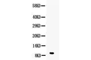 Western blot analysis of DBI using anti-DBI antibody . (Diazepam Binding Inhibitor antibody  (AA 2-87))