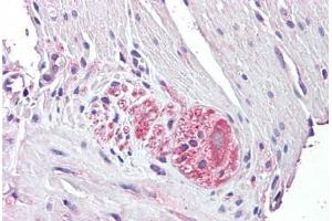 Anti-NTN4 / Netrin 4 antibody IHC staining of human small intestine, myenteric plexus. (Netrin 4 antibody  (AA 65-76))