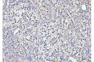 IHC analysis of ITCH/AIP4 using anti-ITCH/AIP4 antibody (ABIN7600263). (ITCH antibody  (AA 17-358))