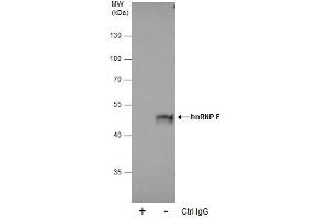 IP Image Immunoprecipitation of hnRNP F protein from 293T whole cell extracts using 5 μg of hnRNP F antibody [N1N3], Western blot analysis was performed using hnRNP F antibody [N1N3], EasyBlot anti-Rabbit IgG  was used as a secondary reagent. (HNRNPF antibody)
