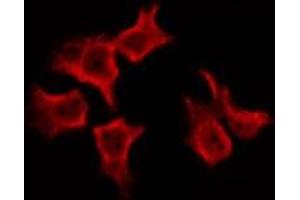 ABIN6269230 staining Hela by IF/ICC. (SREBF1 antibody)