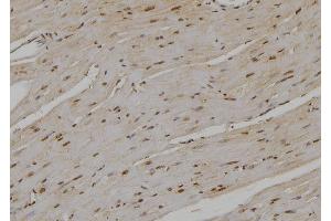 ABIN6276978 at 1/100 staining Rat heart tissue by IHC-P. (UBE2D1 antibody  (C-Term))