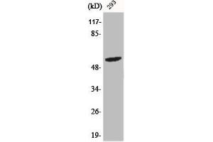 Western Blot analysis of 293 cells using Phospho-Shb (Y246) Polyclonal Antibody (SHB antibody  (pTyr246))