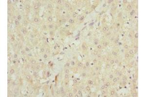 Immunohistochemistry of paraffin-embedded human liver tissue using ABIN7151087 at dilution of 1:100 (NHLRC1 antibody  (AA 1-280))
